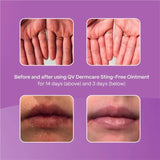 QV Dermcare Sting-Free Ointment - 100g Tube
